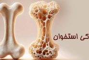 پوکی استخوان؛ بیماری خاموش اما قابل پیشگیری