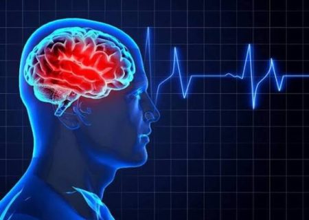 نجات جان بیش از ۴۰ بیمار سکته مغزی در سال با فعال‌سازی کد ۷۲۴ در بیمارستان پیمانیه