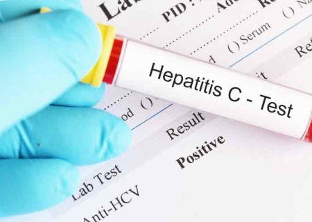 شناسایی یک بیمار مبتلا به هپاتیت C در پویش غربالگری؛ نجات جان بیمار با تشخیص به موقع