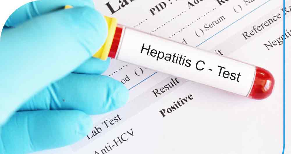 شناسایی یک بیمار مبتلا به هپاتیت C در پویش غربالگری؛ نجات جان بیمار با تشخیص به موقع